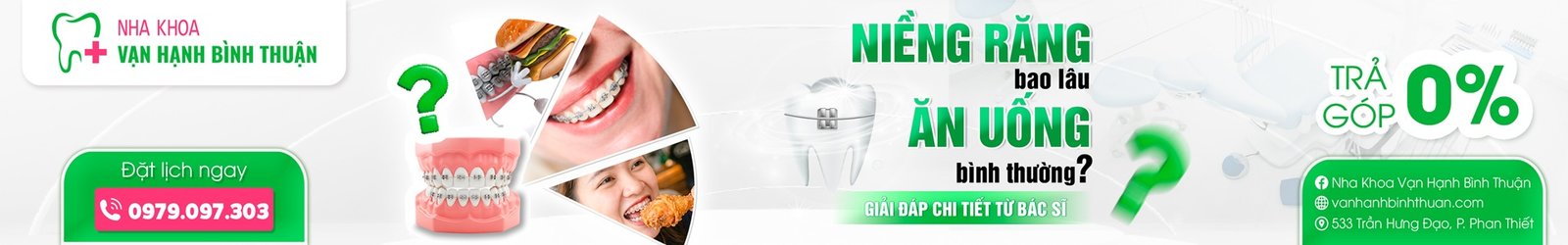 Niềng răng bao lâu ăn uống bình thường? Giải đáp chi tiết từ bác sĩ